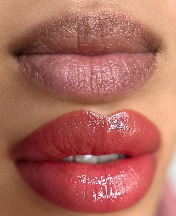 Mily La Esthetic — Lip Blush
